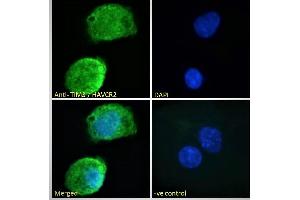 Image no. 5 for anti-Hepatitis A Virus Cellular Receptor 2 (TIM 3) (Internal Region) antibody (ABIN185571)