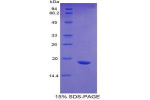 Image no. 1 for Interleukin 17 (IL17) (AA 25-169) protein (His tag,GST tag) (ABIN1877825)