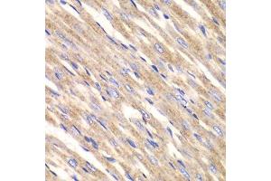 Image no. 3 for anti-Solute Carrier Family 25 (Mitochondrial Carrier, Adenine Nucleotide Translocator), Member 4 (SLC25A4) antibody (ABIN3022646)