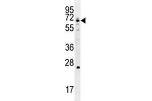 Image no. 7 for anti-Glutamate-Cysteine Ligase, Catalytic Subunit (GCLC) (AA 1-30) antibody (ABIN3031076)