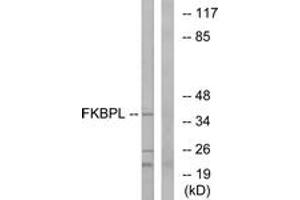 Image no. 1 for anti-FK506 Binding Protein Like (FKBPL) (AA 251-300) antibody (ABIN1534906)