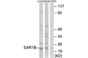 Image no. 1 for anti-SAR1 Homolog B (SAR1B) (AA 111-160) antibody (ABIN1534966)