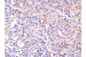 Image no. 2 for anti-Lymphocyte Antigen 96 (LY96) antibody (ABIN6655734)