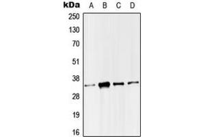 Image no. 2 for anti-Single-Strand-Selective Monofunctional Uracil-DNA Glycosylase 1 (SMUG1) (Center) antibody (ABIN2707077)