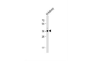 Image no. 2 for anti-Legumain (LGMN) (AA 83-112), (N-Term) antibody (ABIN1881495)