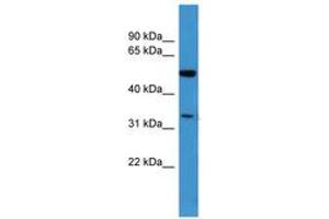 Image no. 1 for anti-Ceramide Kinase-Like (CERKL) (AA 137-186) antibody (ABIN6746688)