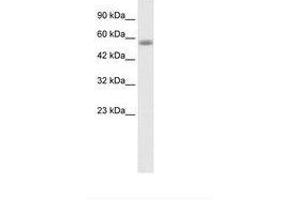 Image no. 1 for anti-Kelch-Like 36 (KLHL36) (AA 134-183) antibody (ABIN202817)