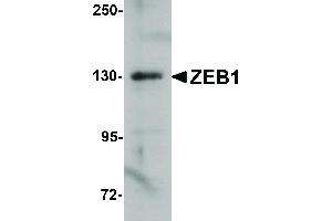 Image no. 1 for anti-Zinc Finger E-Box Binding Homeobox 1 (ZEB1) (Internal Region) antibody (ABIN6655285)