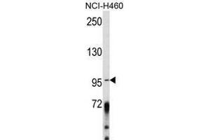 Image no. 1 for anti-A Kinase (PRKA) Anchor Protein 3 (AKAP3) (Middle Region) antibody (ABIN452728)