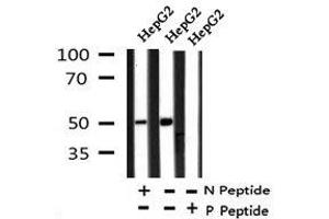 Image no. 3 for anti-Y Box Binding Protein 1 (YBX1) (pSer176) antibody (ABIN6270076)
