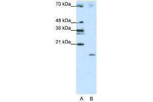 Image no. 2 for anti-Signal Recognition Particle 19kDa (SRP19) (Middle Region) antibody (ABIN629983)