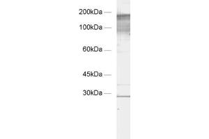 Image no. 1 for anti-Regulating Synaptic Membrane Exocytosis 1 (RIMS1) (AA 955-1156) antibody (ABIN1742307)