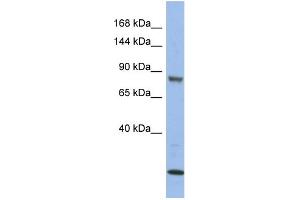 Image no. 1 for anti-Mitogen-Activated Protein Kinase Kinase Kinase 11 (MAP3K11) (Middle Region) antibody (ABIN2786655)