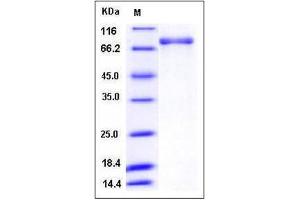 Image no. 1 for phosphodiesterase 1B, Calmodulin-Dependent (PDE1B) (AA 1-536) protein (GST tag,His tag) (ABIN2004749)