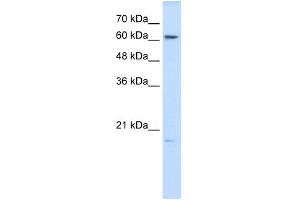 anti-Glutathione Peroxidase 3 (Plasma) (GPX3) (N-Term) antibody