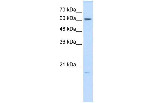 anti-Glutathione Peroxidase 3 (Plasma) (GPX3) (N-Term) antibody