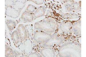 IHC-P Image Immunohistochemical analysis of paraffin-embedded human lymphocytes in gastric epithelium, using HCLS1, antibody at 1:100 dilution.