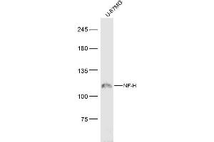 Image no. 3 for anti-Neurofilament, Heavy Polypeptide (NEFH) (AA 21-120) antibody (ABIN2177936)