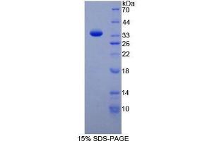 Image no. 1 for TAF1 RNA Polymerase II, TATA Box Binding Protein (TBP)-Associated Factor (TAF1) (AA 1379-1636) protein (His tag) (ABIN1878682)