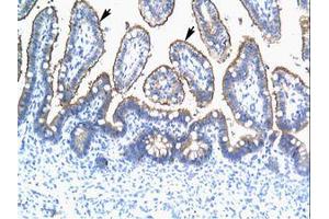 Image no. 2 for anti-Tripartite Motif Containing 15 (TRIM15) (AA 141-190) antibody (ABIN202591)