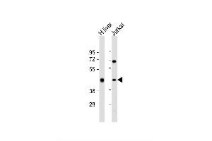 Image no. 4 for anti-Alcohol Dehydrogenase 1B (Class I), beta Polypeptide (ADH1B) (AA 209-237) antibody (ABIN390699)