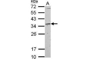 Image no. 5 for anti-Fibrillarin (FBL) (Center) antibody (ABIN2855179)