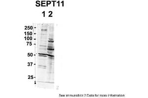 Image no. 2 for anti-Septin 11 (SEPT11) (N-Term) antibody (ABIN2787099)