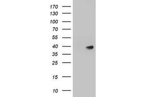 Image no. 1 for anti-alpha-1,4-N-Acetylglucosaminyltransferase (A4GNT) (AA 121-340) antibody (ABIN2715589)