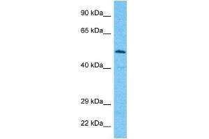 Image no. 1 for anti-Asparagine-Linked Glycosylation 9, alpha-1,2-Mannosyltransferase (ALG9) (Middle Region) antibody (ABIN5517908)
