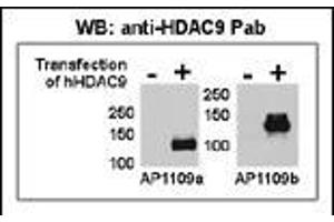 Image no. 3 for anti-Histone Deacetylase 9 (HDAC9) (AA 2-32), (N-Term) antibody (ABIN387960)