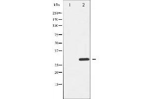 Image no. 2 for anti-BCL2-Interacting Killer (Apoptosis-Inducing) (BIK) (pThr33) antibody (ABIN6255669)
