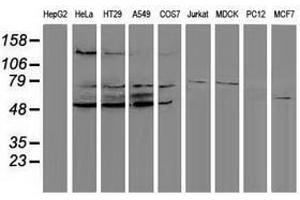 Image no. 2 for anti-Protein Phosphatase, Mg2+/Mn2+ Dependent, 1G (PPM1G) antibody (ABIN1500378)