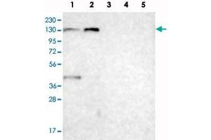 Image no. 3 for anti-Chromosome 6 Open Reading Frame 170 (C6ORF170) antibody (ABIN5573433)