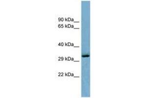 Image no. 1 for anti-OTU Domain Containing 6B (OTUD6B) (C-Term) antibody (ABIN6741941)