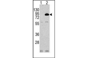 Image no. 2 for anti-Phosphoinositide 3 Kinase, p85 beta (PI3K p85b) (N-Term) antibody (ABIN360465)