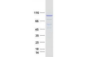 Image no. 1 for Minichromosome Maintenance Complex Component 7 (MCM7) (Transcript Variant 1) protein (Myc-DYKDDDDK Tag) (ABIN2725636)