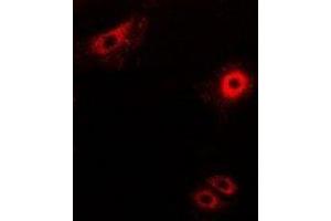 Image no. 1 for anti-Secretogranin II (SCG2) antibody (ABIN2967017)