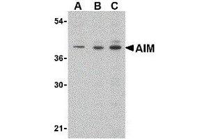 Image no. 1 for anti-CD5 Molecule-Like (CD5L) (C-Term) antibody (ABIN2472165)