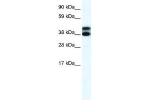 Image no. 1 for anti-Tripartite Motif Containing 13 (TRIM13) (Middle Region) antibody (ABIN927474)