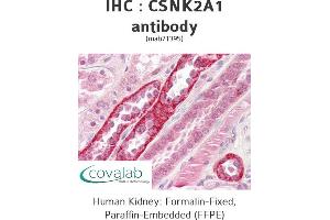 Image no. 1 for anti-Casein Kinase 2 alpha 1 (CSNK2A1) antibody (ABIN1724456)