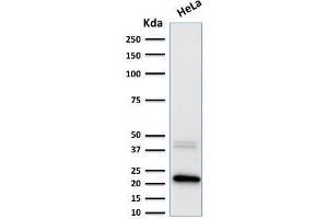 Image no. 3 for anti-Ferritin, Light Polypeptide (FTL) (AA 38-165) antibody (ABIN6939461)