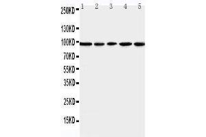 anti-Minichromosome Maintenance Complex Component 6 (MCM6) (AA 589-605), (Middle Region) antibody