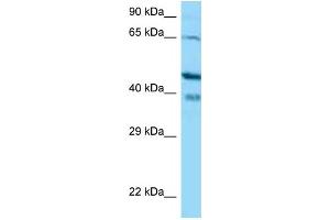 Image no. 1 for anti-Calcium Binding Protein 1 (CABP1) (N-Term) antibody (ABIN2774384)