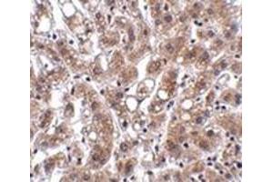Image no. 2 for anti-Thioesterase Superfamily Member 4 (THEM4) (Center) antibody (ABIN500905)