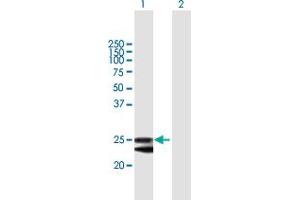 Image no. 1 for anti-FK506 Binding Protein 14, 22 KDa (FKBP14) (AA 1-211) antibody (ABIN527313)
