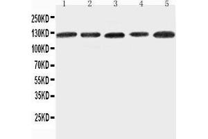 Image no. 1 for anti-Integrin, alpha 7 (ITGA7) (AA 1123-1139), (C-Term) antibody (ABIN3042822)