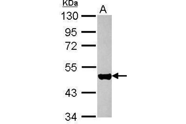 KRT17 anticorps  (Center)