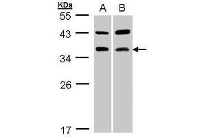 Image no. 1 for anti-CD40 Ligand (CD40LG) (Center) antibody (ABIN2854749)