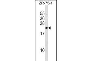 GRPEL1 anticorps  (AA 116-142)