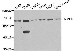 Image no. 2 for anti-Microseminoprotein, beta (MSMB) antibody (ABIN3015771)